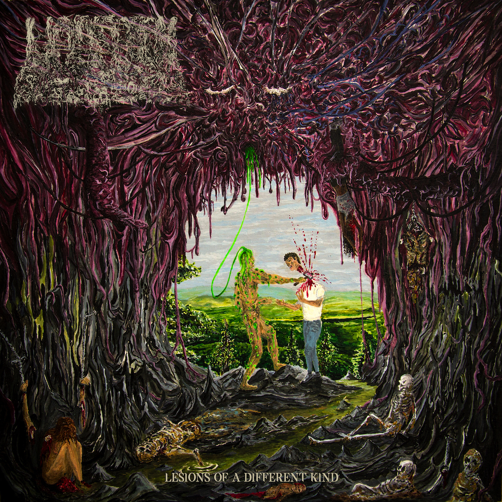 UNDEATH “Lesions Of A Different Kind”